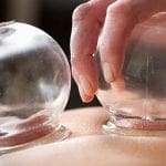 Michael-Phelps cupping